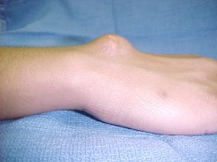 4453-4463-5247-11781